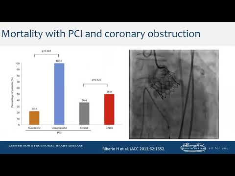 Coronary Occlusion Management- Marvin Eng, MD