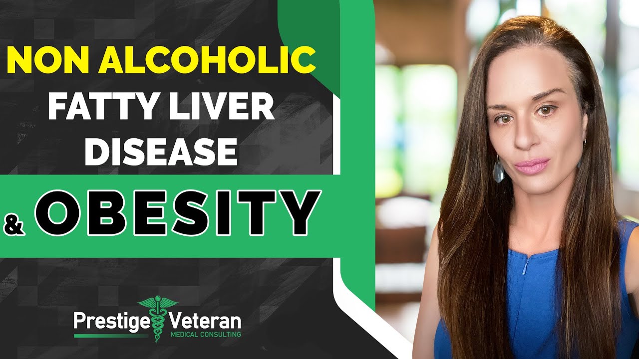 Non Alcoholic Fatty Liver Disease & Obesity as an Intermediate Step in Veterans Disability