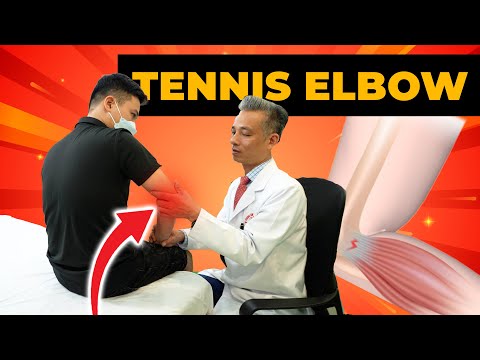 Đau Cùi Chỏ Không Thể Cầm Cốc Nước? Bác Sĩ Hướng Dẫn Chữa Tennis Elbow