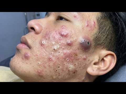 Loan Nguyen 10