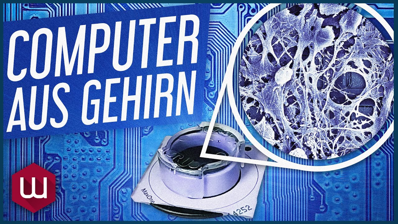 Erster Computer aus Gehirnzellen schlägt schon jetzt klassische KI