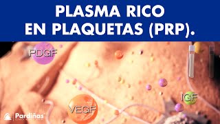 Plasma Rico en Plaquetas © - Clínica Dental Pardiñas