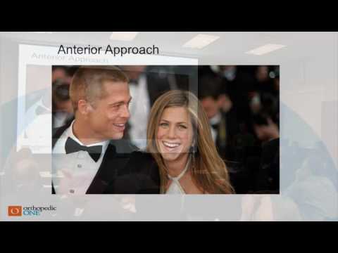 Dr. Bryan Chambers -  Total Hip Surgical Approaches - 5/7/16