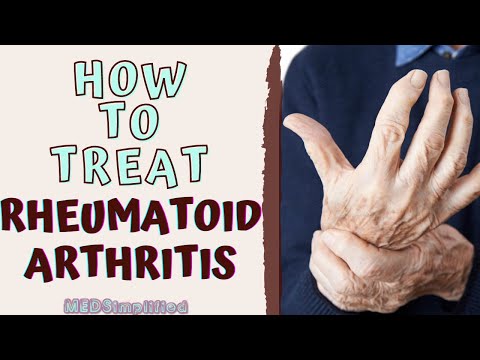 A korábbi rheumatoid arthritis kezelésére került sor