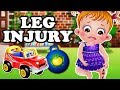 Baby Hazel Leg Injury Fun Game Videos By Baby Hazel Games