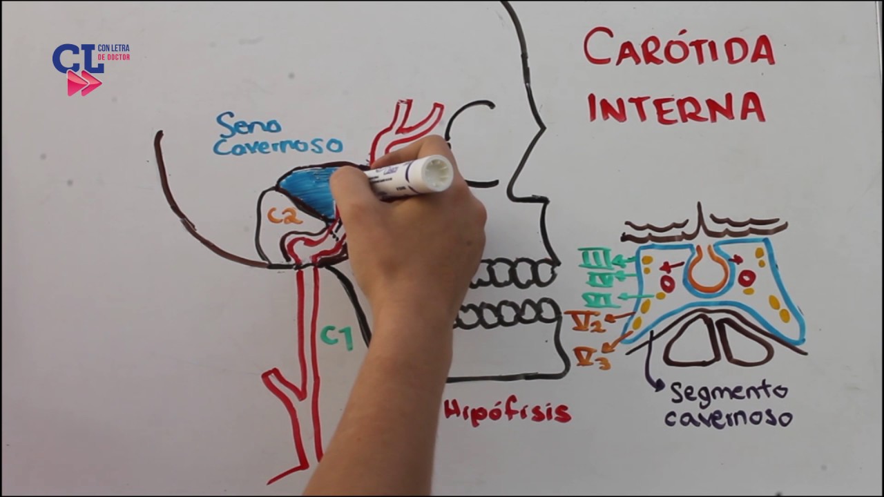 VASCULARIZACION ARTERIAL ENCEFALICA PARTE 1: carotida interna