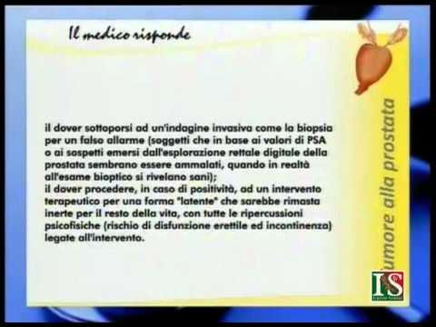 ASD candele recensioni prostatite Come trattare fibroma della prostata