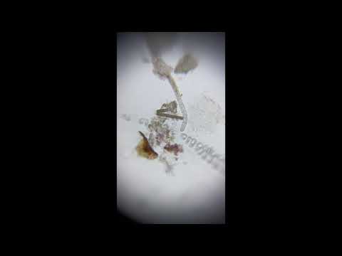 Detritus Worms Found on Aquarium Filter System