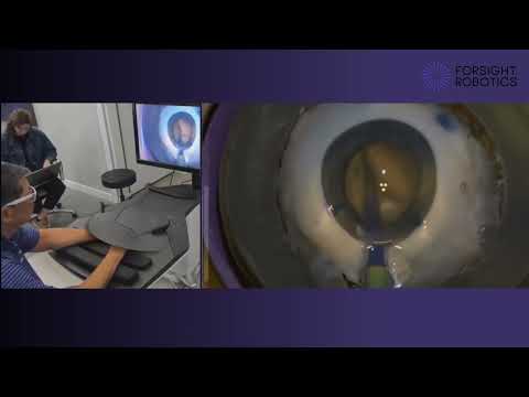 Robotic Cataract Surgery | Dr. David Chang Using ForSight's ORYOM™ Platform