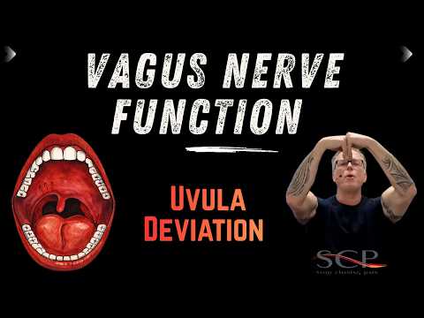 Vagus Nerve Function Uvula Deviation
