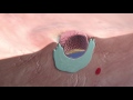 Implantation of the blastocyst