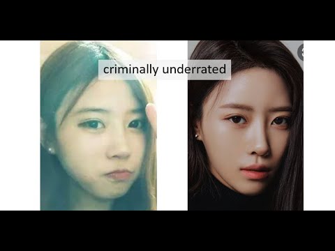 LOVELYZ PLASTIC SURGERY ANALYSIS