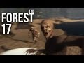 THE FOREST [HD+] #017 - Ladebildschirm des ...