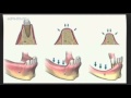 video thumbnail (3)