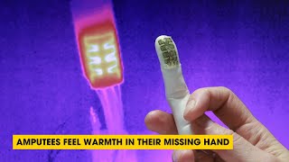 Podcast: Amputees Feel Warmth In Their Missing Hand