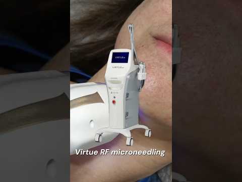 Tighten, Smooth & Renew | Virtue RF Microneedling