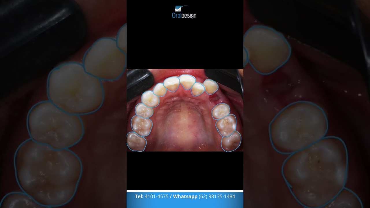 Danilo Monteiro Rezende Pereira-40
