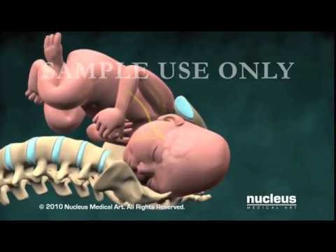 download lagu mp3 mp4 Lecture Notes Obstetrics And Gynaecology, download lagu Lecture Notes Obstetrics And Gynaecology gratis, unduh video klip Lecture Notes Obstetrics And Gynaecology