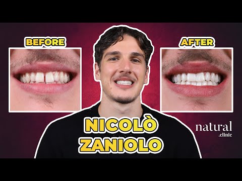Nicol&ograve; Zaniolo Testimonial