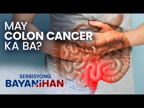 Alamin ang mga sanhi ng pagkakaroon ng colon cancer