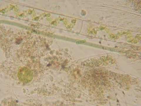 Microscope view of some pond scum