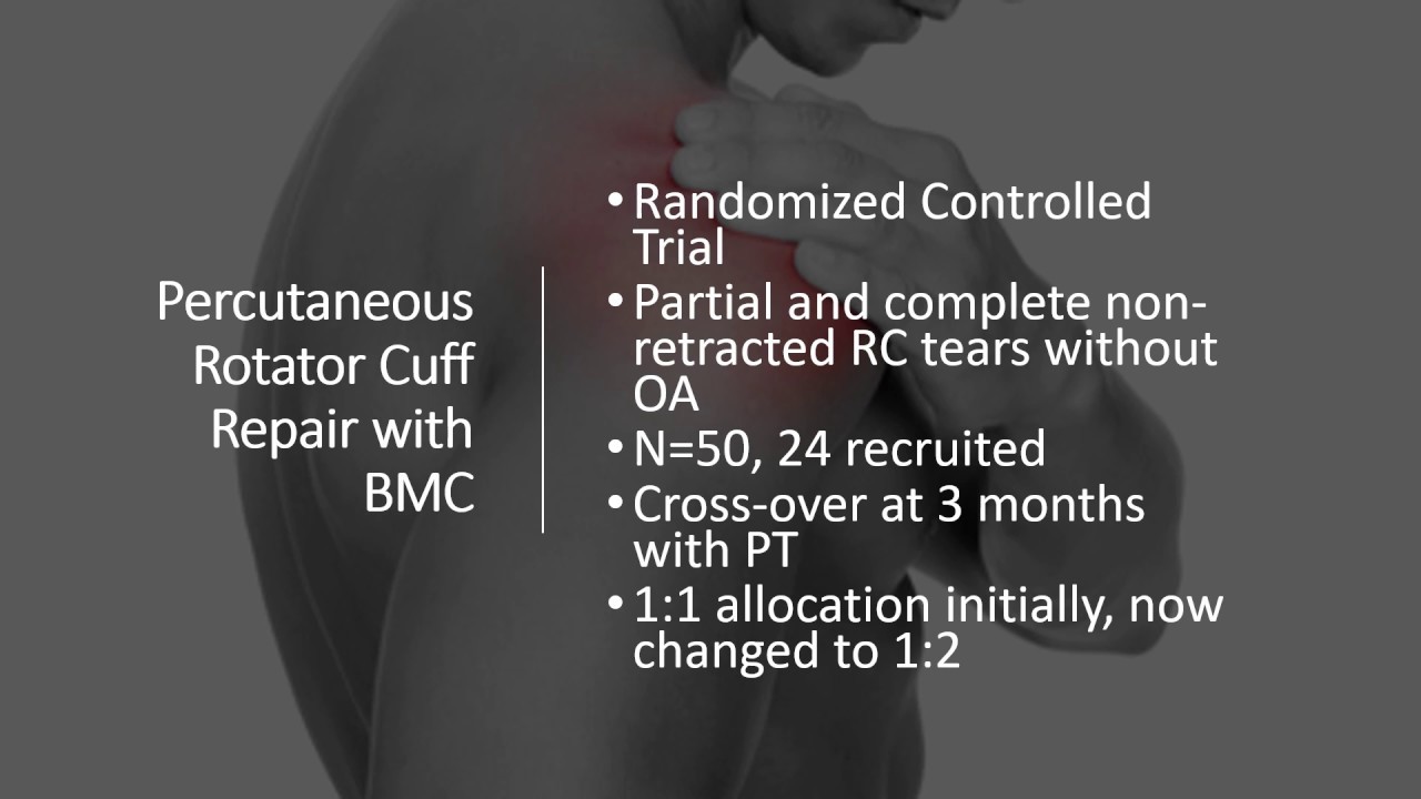 rotator cuff stem cell treatment rotator cuff stem cell treatment
