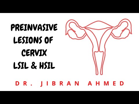 ENDOMETRIAL CARCINOMA II FEMALE GENITAL TRACT II ROBBINS 10TH E II PATHOLOGY LECTURE