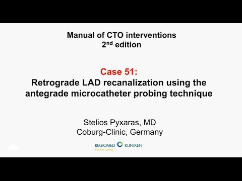 Case 51: Manual of CTO Interventions - Retrograde for proximal cap ambiguity
