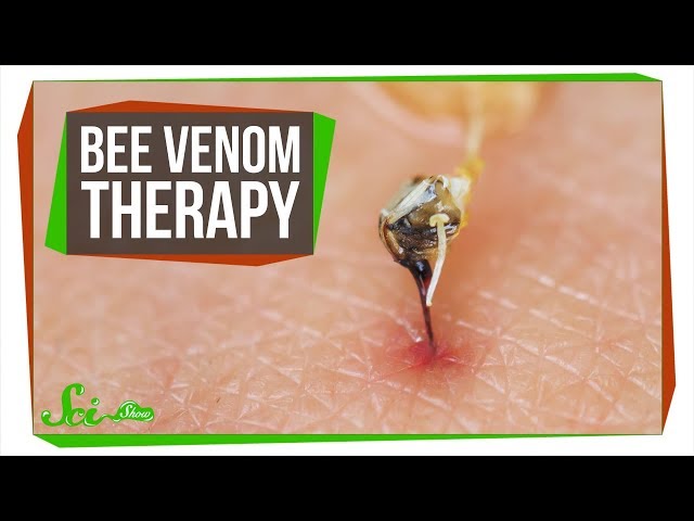 Video de pronunciación de bee sting en Inglés