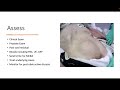 Urology Common Conditions Part 1