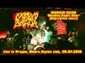 Oxidised Razor "Bleeding Peptic Ulcer" (Regurgitate cover)