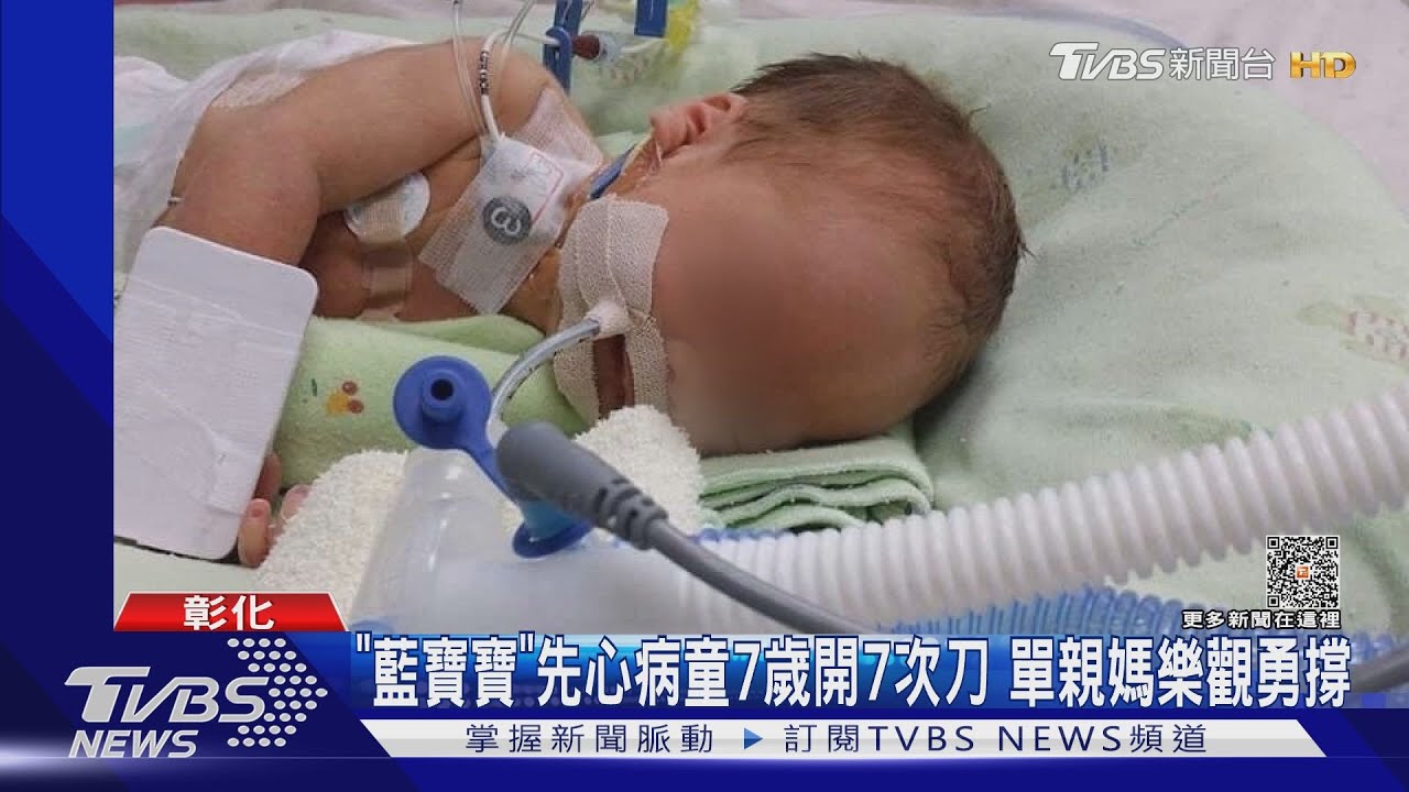 「藍寶寶」先心病童7歲開7次刀　單親媽樂觀勇撐