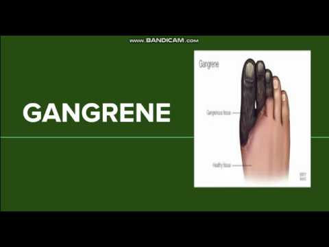 Gangrene: Dry, Wet and Gas Gangrene