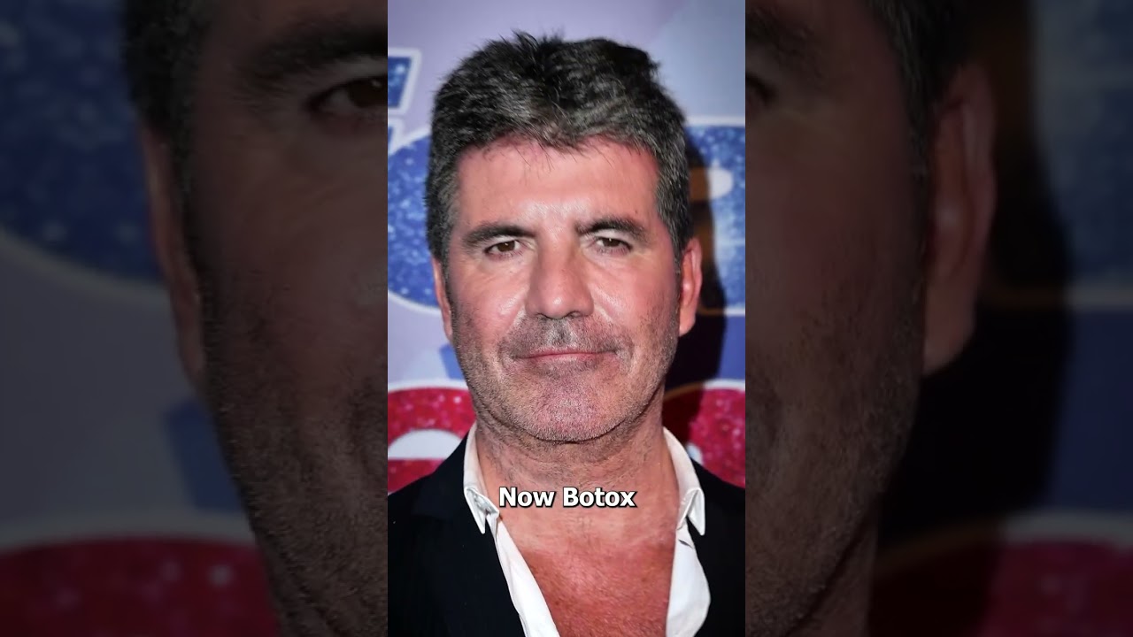 How Botox Actually Works 💉🤔