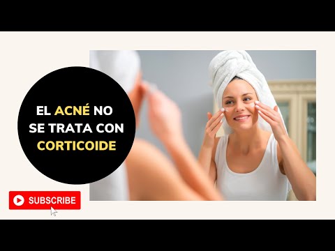 ACNÉ NO se trata con CORTICOIDE