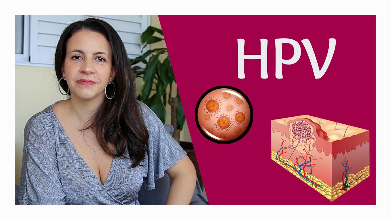 Quais os tipos de lesões do HPV? Como saber se eu tenho? 🦠