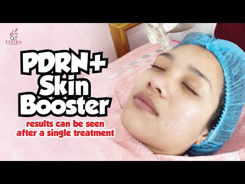 ESTIKA MEDISPA TESTIMONIAL | PDRN+ Skin Booster