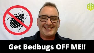 Get Bedbugs off your body