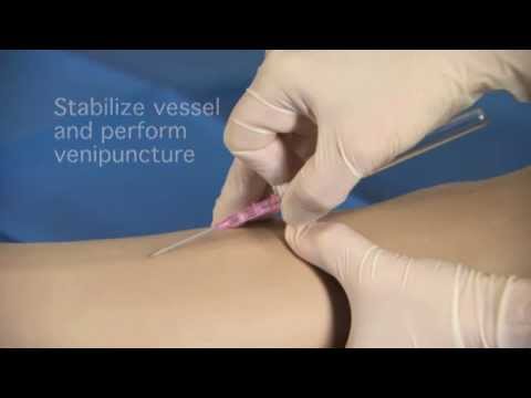 BD Insyte Autoguard BC Protective IV catheters