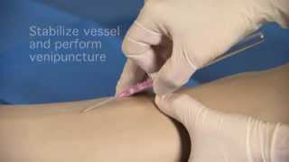 Product video: BD Insyte Autoguard Shielded IV Catheter