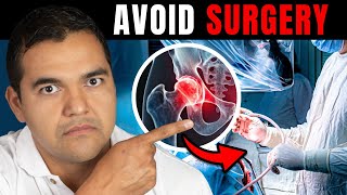 Avoid Hip Replacement Surgery with These 4 Exercises