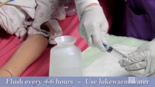 J Tube (Jejunostomy) Feeding Tube Care Instructions | Roswell Park Patient Education