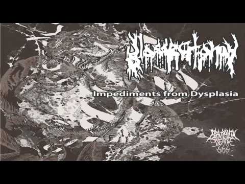 Glossectomy - Impediments From Dysplasia (2014) {Full-EP}