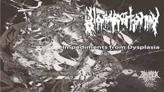 Glossectomy - Impediments From Dysplasia (2014) {Full-EP}