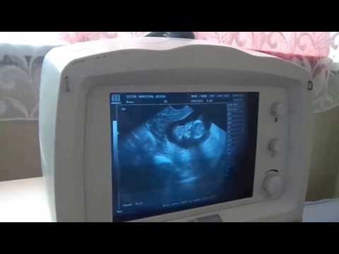Hip sostituzione nel prezzo Chelyabinsk Mal di collo e le orecchie spuntato cosa fare