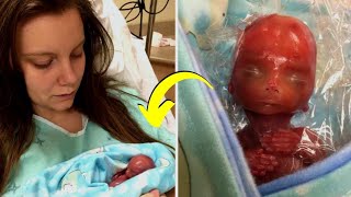 Baby born at 18 weeks when the mother put him in her chest she was shocked