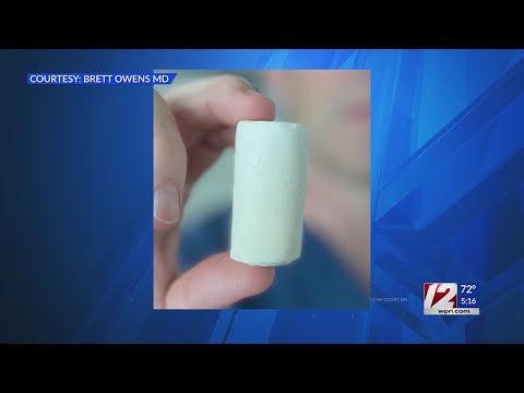 Clinical trial testing new way to repair torn ACL