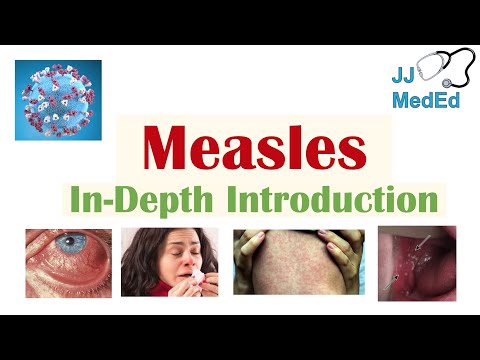 Introduction to Measles | Causes, Risk Factors, Transmission, Stages of Infection, Signs & Symptoms
