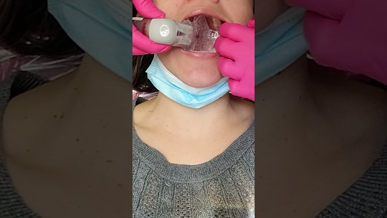 Dental isolation: IsoDry #shorts