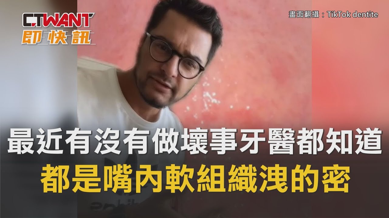 圖說-最近有沒有做壞事牙醫都知道　都是嘴內軟組織洩的密